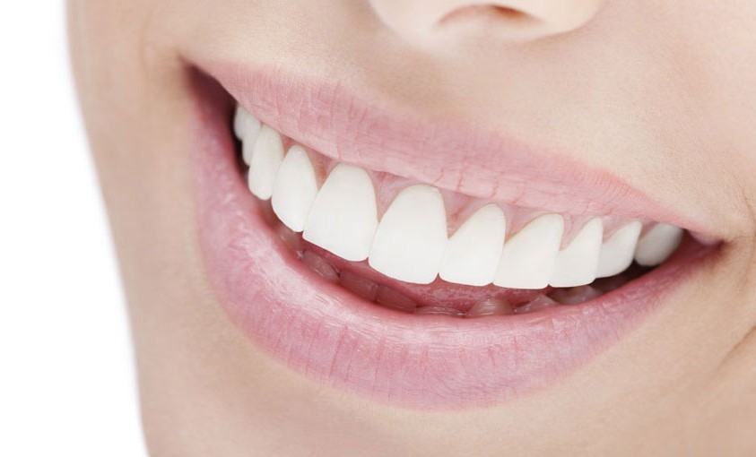 Un sourire éclatant, un signe de beauté, un signe de santé, un signe de jeunesse.