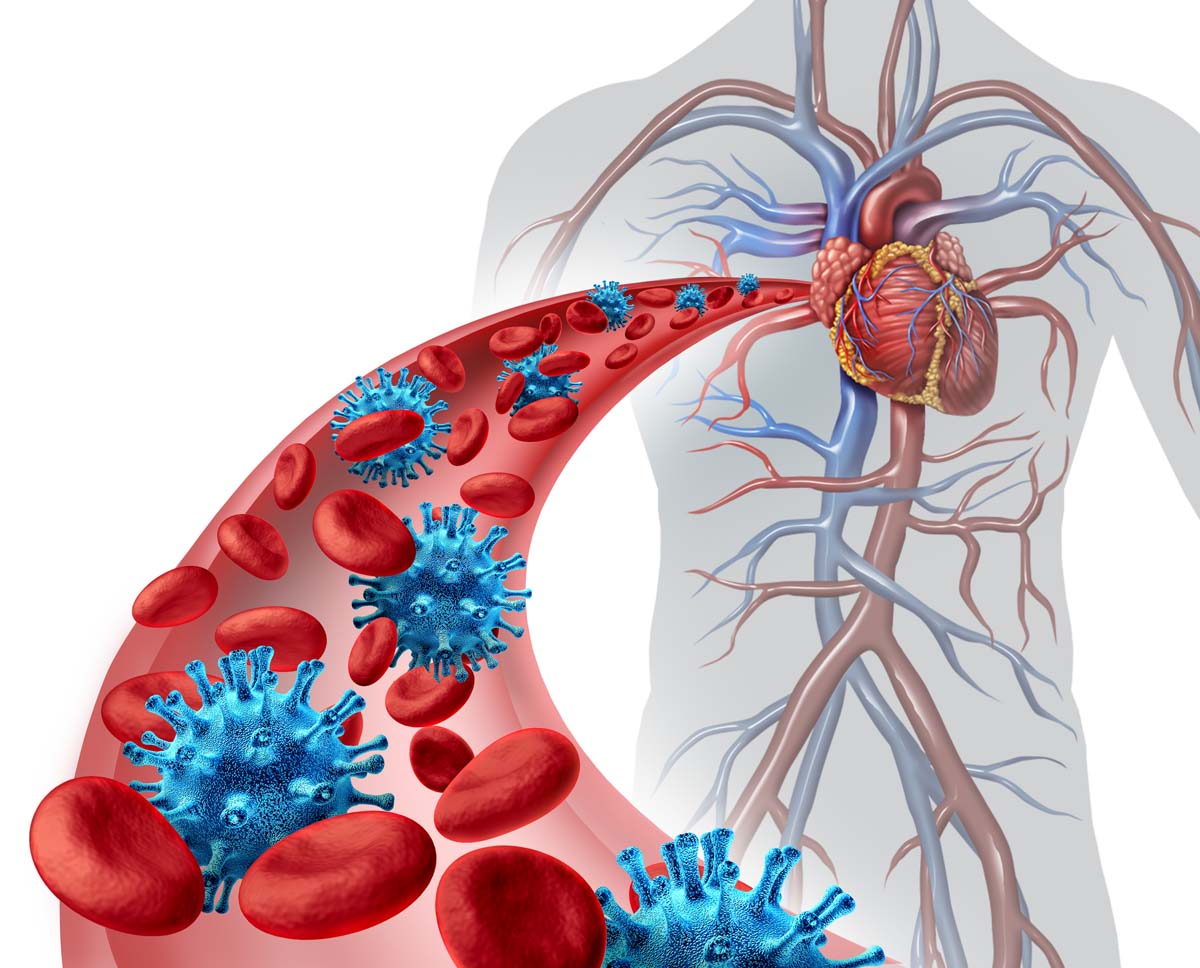 Le cœur et l’infection bactérienne dentaire et gingivale.