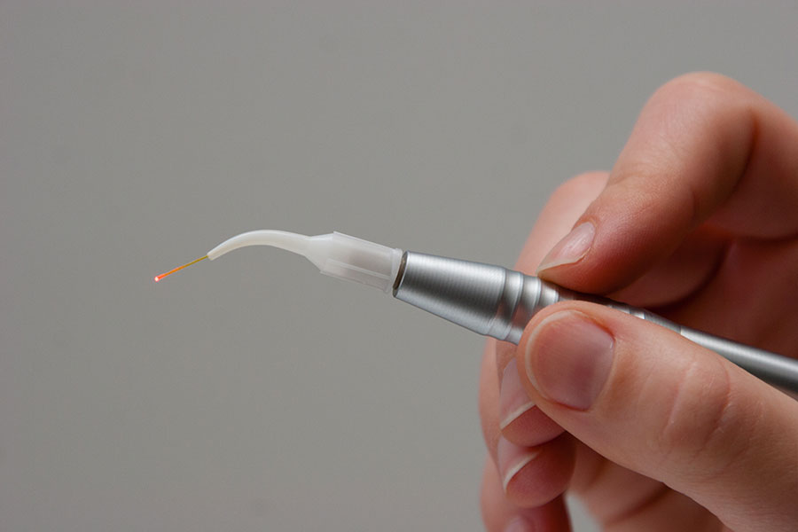 Traitement au laser dans la centre dentaire Al Denté à St Jérôme.