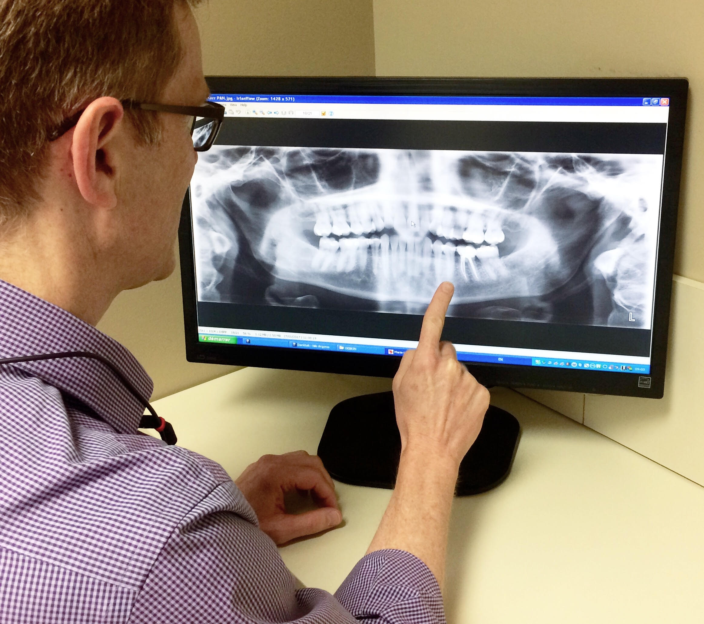 La radiographie numérique dans la centre dentaire Al denté Saint Jérôme.